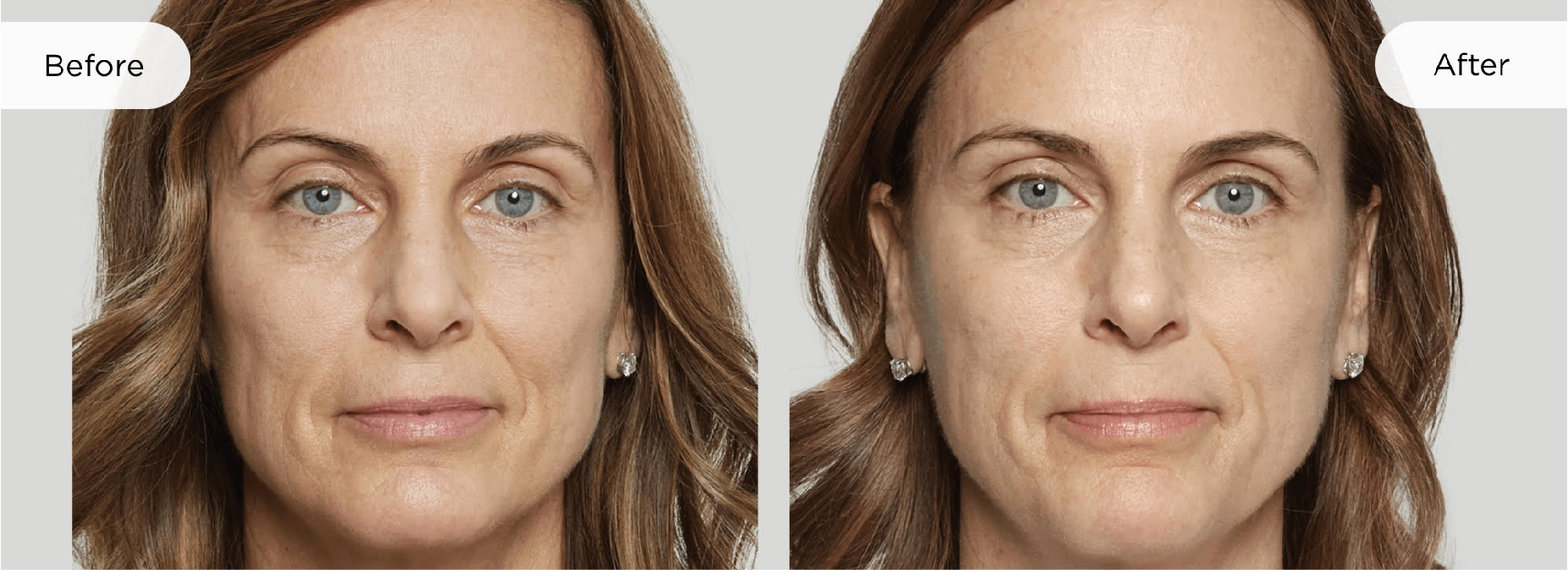 woman before and after